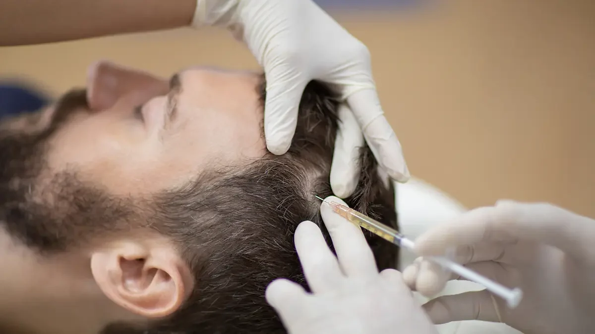 Exosome Hair Therapy Burnaby: Restore Your Hair
